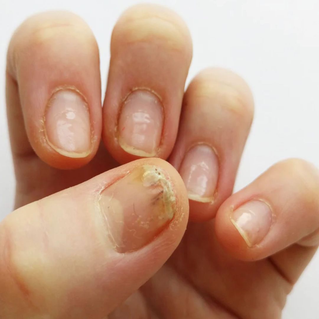 What to Expect from Your Brand if Your Client Suffers an Allergic Reaction